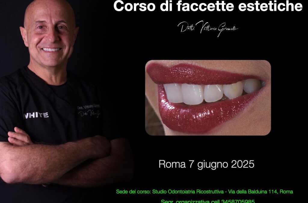 Corso Didattico Faccette – Modulo 2 con il Dott. Vittorio Giannelli